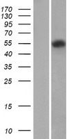 PROC / Protein C Protein - Western validation with an anti-DDK antibody * L: Control HEK293 lysate R: Over-expression lysate