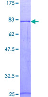 PROC / Protein C Protein - 12.5% SDS-PAGE of human PROC stained with Coomassie Blue