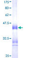 PROC / Protein C Protein - 12.5% SDS-PAGE Stained with Coomassie Blue.