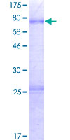 PROCA1 Protein - 12.5% SDS-PAGE of human PROCA1 stained with Coomassie Blue