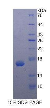 Procalcitonin Protein - Recombinant Procalcitonin By SDS-PAGE