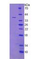 Procollagen III N-Terminal Propeptide Protein - Recombinant Procollagen III N-Terminal Propeptide (PIIINP) by SDS-PAGE