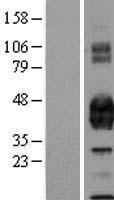 PROCR / EPCR Protein - Western validation with an anti-DDK antibody * L: Control HEK293 lysate R: Over-expression lysate