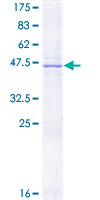 PROCR / EPCR Protein - 12.5% SDS-PAGE of human PROCR stained with Coomassie Blue