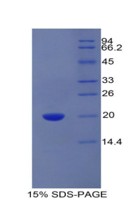 PROCR / EPCR Protein - Recombinant Protein C Receptor, Endothelial By SDS-PAGE