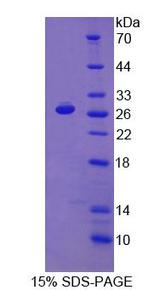 PRODH Protein - Recombinant Proline Dehydrogenase, Mitochondrial By SDS-PAGE