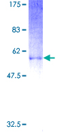 Proenkephalin / PENK Protein - 12.5% SDS-PAGE of human PENK stained with Coomassie Blue