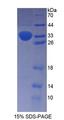 Proenkephalin / PENK Protein - Recombinant  Proenkephalin By SDS-PAGE