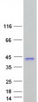 Proenkephalin / PENK Protein - Purified recombinant protein PENK was analyzed by SDS-PAGE gel and Coomassie Blue Staining