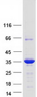 Proenkephalin / PENK Protein - Purified recombinant protein PENK was analyzed by SDS-PAGE gel and Coomassie Blue Staining