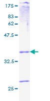 PROK1 / EG-VEGF Protein - 12.5% SDS-PAGE of human PROK1 stained with Coomassie Blue