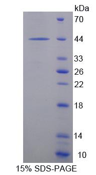 PROK1 / EG-VEGF Protein - Recombinant Endocrine Gland Derived Vascular Endothelial Growth Factor By SDS-PAGE