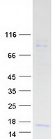Prolactin-Releasing Hormone Protein - Purified recombinant protein PRLH was analyzed by SDS-PAGE gel and Coomassie Blue Staining