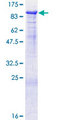 PROS1 / Protein S Protein - 12.5% SDS-PAGE of human PROS1 stained with Coomassie Blue
