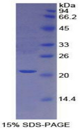 PROS1 / Protein S Protein - Recombinant Protein S By SDS-PAGE