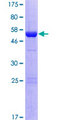 PROSC Protein - 12.5% SDS-PAGE of human PROSC stained with Coomassie Blue