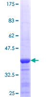 PROSC Protein - 12.5% SDS-PAGE Stained with Coomassie Blue.