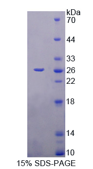 Prostaglandin D Synthase Protein - Recombinant  Prostaglandin D2 Synthase, Hematopoietic By SDS-PAGE