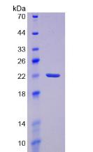 Prostaglandin D Synthase Protein - Recombinant Prostaglandin D2 Synthase, Brain By SDS-PAGE