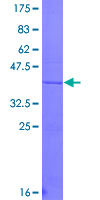 Proteoglycan 4 / Lubricin Protein - 12.5% SDS-PAGE Stained with Coomassie Blue.