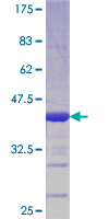 PROX1 Protein - 12.5% SDS-PAGE Stained with Coomassie Blue