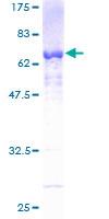 PRPF18 Protein - 12.5% SDS-PAGE of human PRPF18 stained with Coomassie Blue