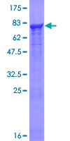 PRPF19 / PRP19 Protein - 12.5% SDS-PAGE of human PRPF19 stained with Coomassie Blue