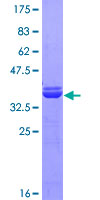 PRPF19 / PRP19 Protein - 12.5% SDS-PAGE Stained with Coomassie Blue.