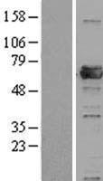PRPF31 Protein - Western validation with an anti-DDK antibody * L: Control HEK293 lysate R: Over-expression lysate