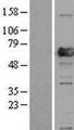 PRPF31 Protein - Western validation with an anti-DDK antibody * L: Control HEK293 lysate R: Over-expression lysate