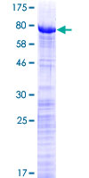 PRPF31 Protein - 12.5% SDS-PAGE of human PRPF31 stained with Coomassie Blue