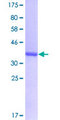 PRPF31 Protein - 12.5% SDS-PAGE Stained with Coomassie Blue.