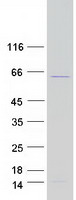 PRPF31 Protein - Purified recombinant protein PRPF31 was analyzed by SDS-PAGE gel and Coomassie Blue Staining