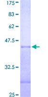 PRPF4B Protein - 12.5% SDS-PAGE Stained with Coomassie Blue.