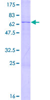 PRPF8 Protein - 12.5% SDS-PAGE of human PRPF8 stained with Coomassie Blue