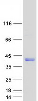 PRPH2 Protein - Purified recombinant protein PRPH2 was analyzed by SDS-PAGE gel and Coomassie Blue Staining