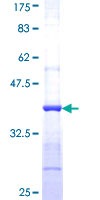 PRPS1L1 Protein - 12.5% SDS-PAGE Stained with Coomassie Blue.