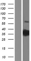 PRPS2 Protein - Western validation with an anti-DDK antibody * L: Control HEK293 lysate R: Over-expression lysate