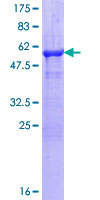 PRPS2 Protein - 12.5% SDS-PAGE of human PRPS2 stained with Coomassie Blue
