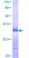 PRPS2 Protein - 12.5% SDS-PAGE Stained with Coomassie Blue.