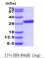 PRPS2 Protein