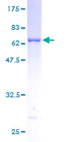 PRPSAP1 Protein - 12.5% SDS-PAGE of human PRPSAP1 stained with Coomassie Blue