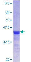 PRPSAP1 Protein - 12.5% SDS-PAGE Stained with Coomassie Blue