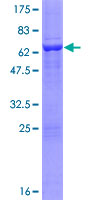 PRPSAP2 Protein - 12.5% SDS-PAGE of human PRPSAP2 stained with Coomassie Blue