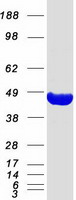 PRPSAP2 Protein - Purified recombinant protein PRPSAP2 was analyzed by SDS-PAGE gel and Coomassie Blue Staining