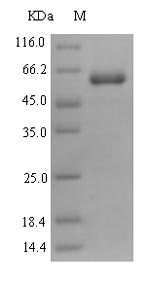 PRR11 Protein - (Tris-Glycine gel) Discontinuous SDS-PAGE (reduced) with 5% enrichment gel and 15% separation gel.