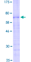 PRR11 Protein - 12.5% SDS-PAGE of human PRR11 stained with Coomassie Blue