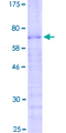 PRR11 Protein - 12.5% SDS-PAGE of human PRR11 stained with Coomassie Blue