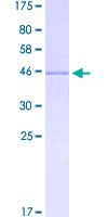 PRR13 Protein - 12.5% SDS-PAGE of human PRR13 stained with Coomassie Blue