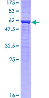 PRR16 Protein - 12.5% SDS-PAGE of human LOC51334 stained with Coomassie Blue